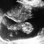 xp3-dot-us_Baby-Ultrasound_12-21-10-800x533